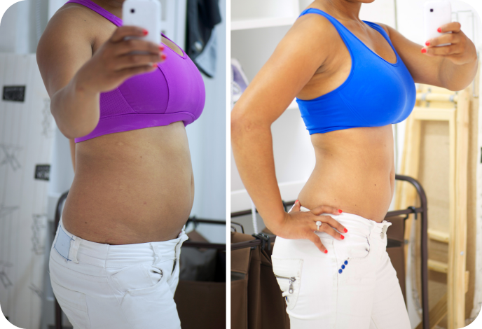 Before and after photos of a woman showing reduced waist size and improved body composition
